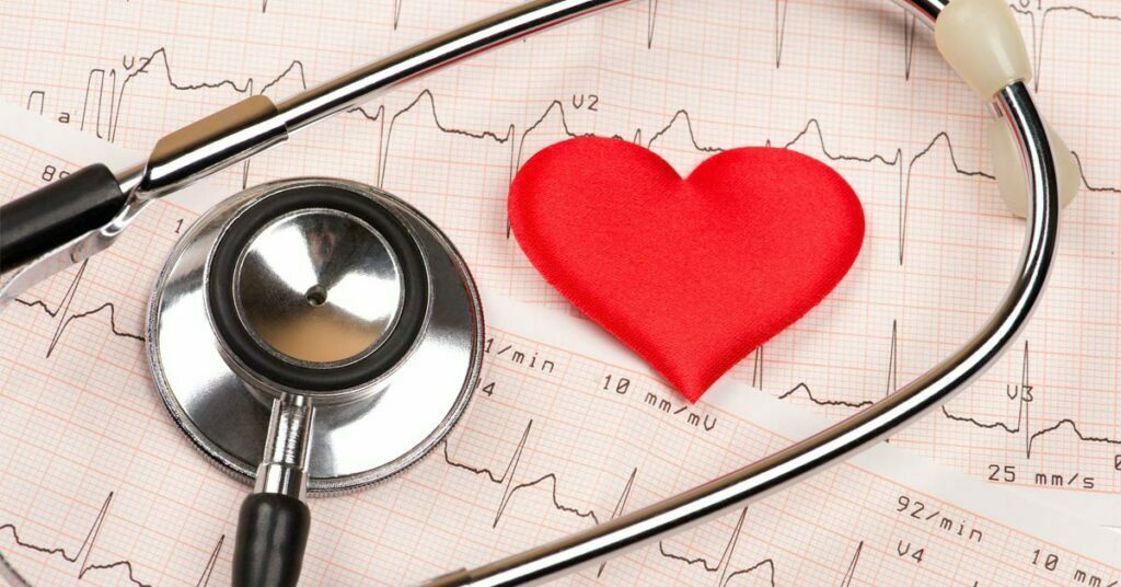 picture of hypertrophic cardiomyopathy