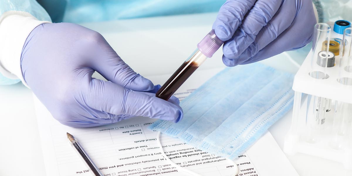 blood test for testing dyslipidemia blood test for testing dyslipidemia