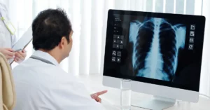 doctors discussing lung cancer x-ray